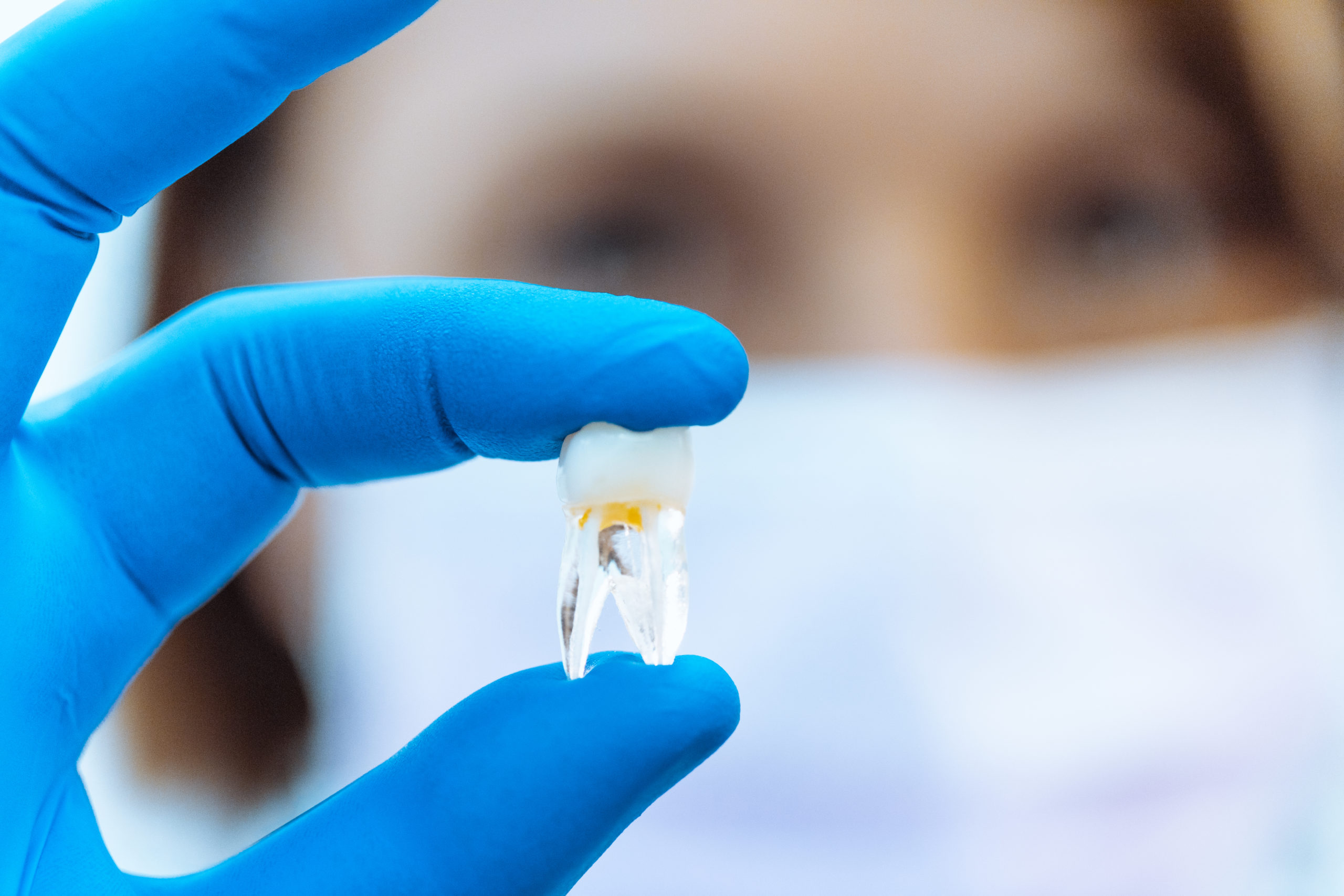 Medico sfuocato con dente